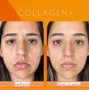 Our-blend-of-Antioxidants_-Ceramides-and-Collagen-Peptides-offers___Helps-support-collagen-and-elastin-formation__Supports-skin-hydration-and-healthy-moistu-295x300-1-1.jpg